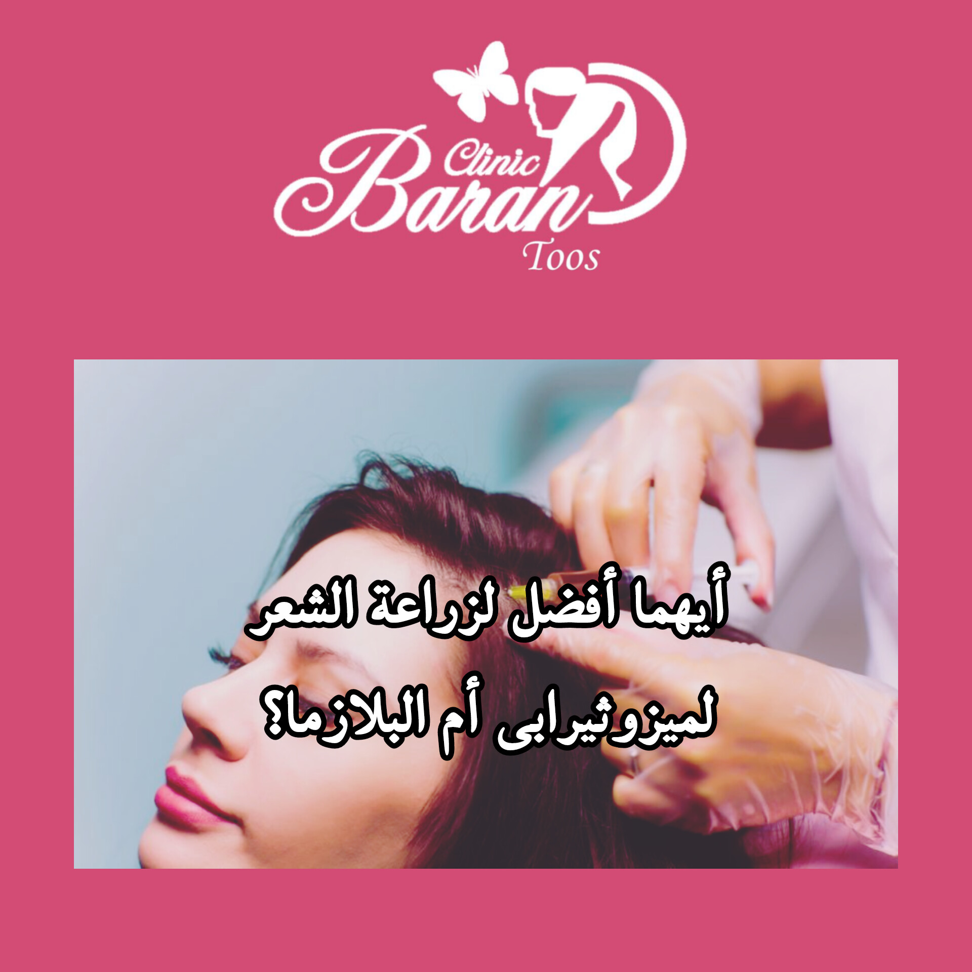 أيهما أفضل لزراعة الشعر، الميزوثيرابي أم البلازما؟